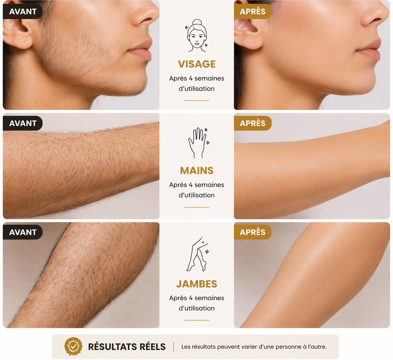 IPL haire removal device (corps, visage, mailot, aisselles)